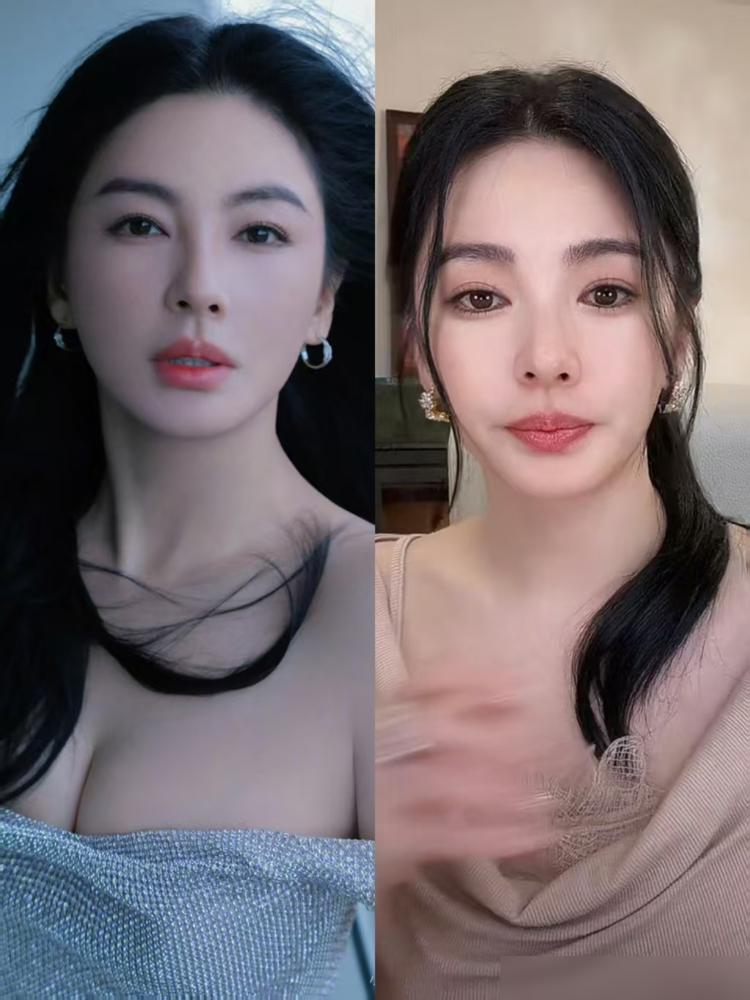 张雨绮那张脸真的不能再动了。直播间里她拼命想挤出一个温柔的笑，可那层皮肉就像被胶