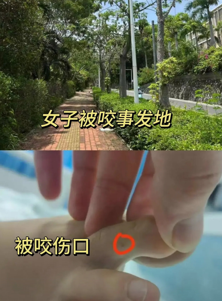 三亚被咬女子家人又曝光了这几个细节:1、原来女子被咬的地方，不是草地边，
