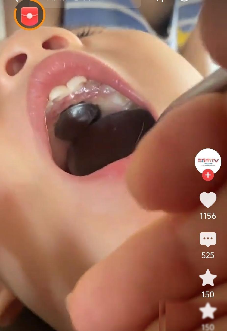 熊孩子把硬币吞进嘴里，硬币还牢牢粘在里面。熊家长赶忙用勺子去处理，这一幕真正让人
