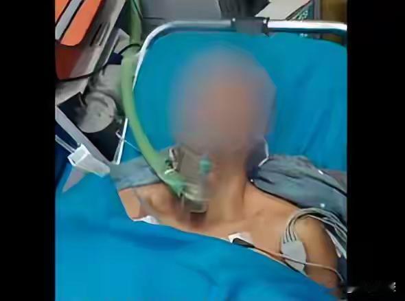 男子夜晚钓鱼被枪击致重伤，家属：4名打猎者误以为他是猎物湖南南县一名男子晚