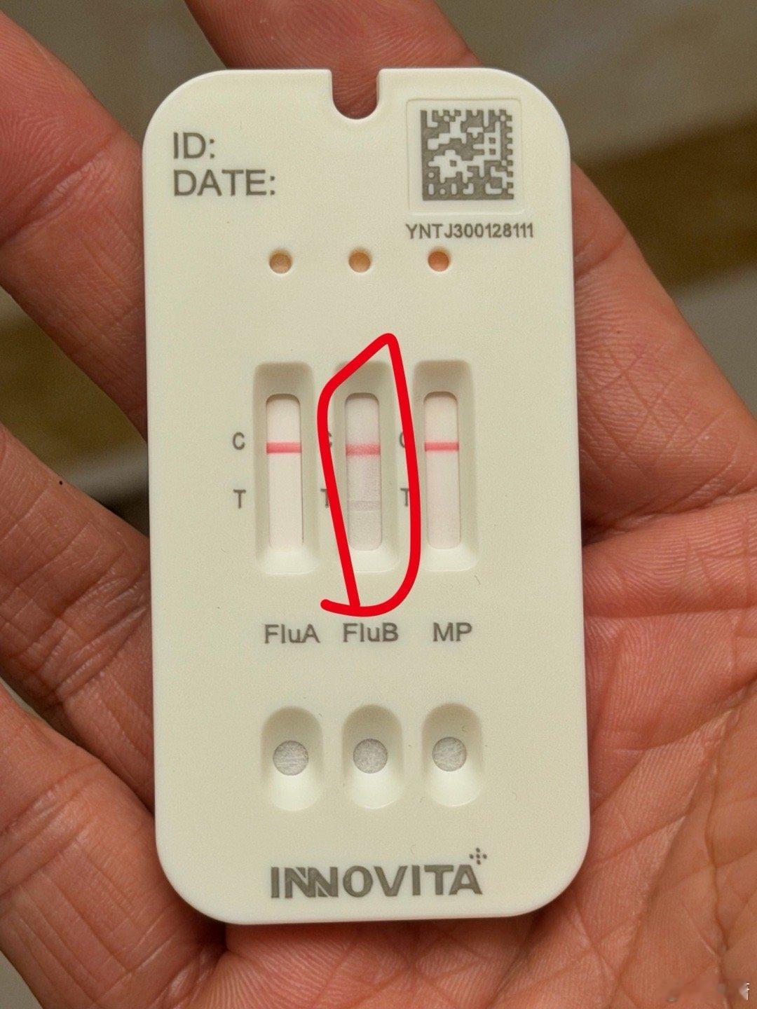 中间是乙流我这个算不算两道杠吧？昨天晚上确实有点点低烧没有啥症状甚至都不难受，今