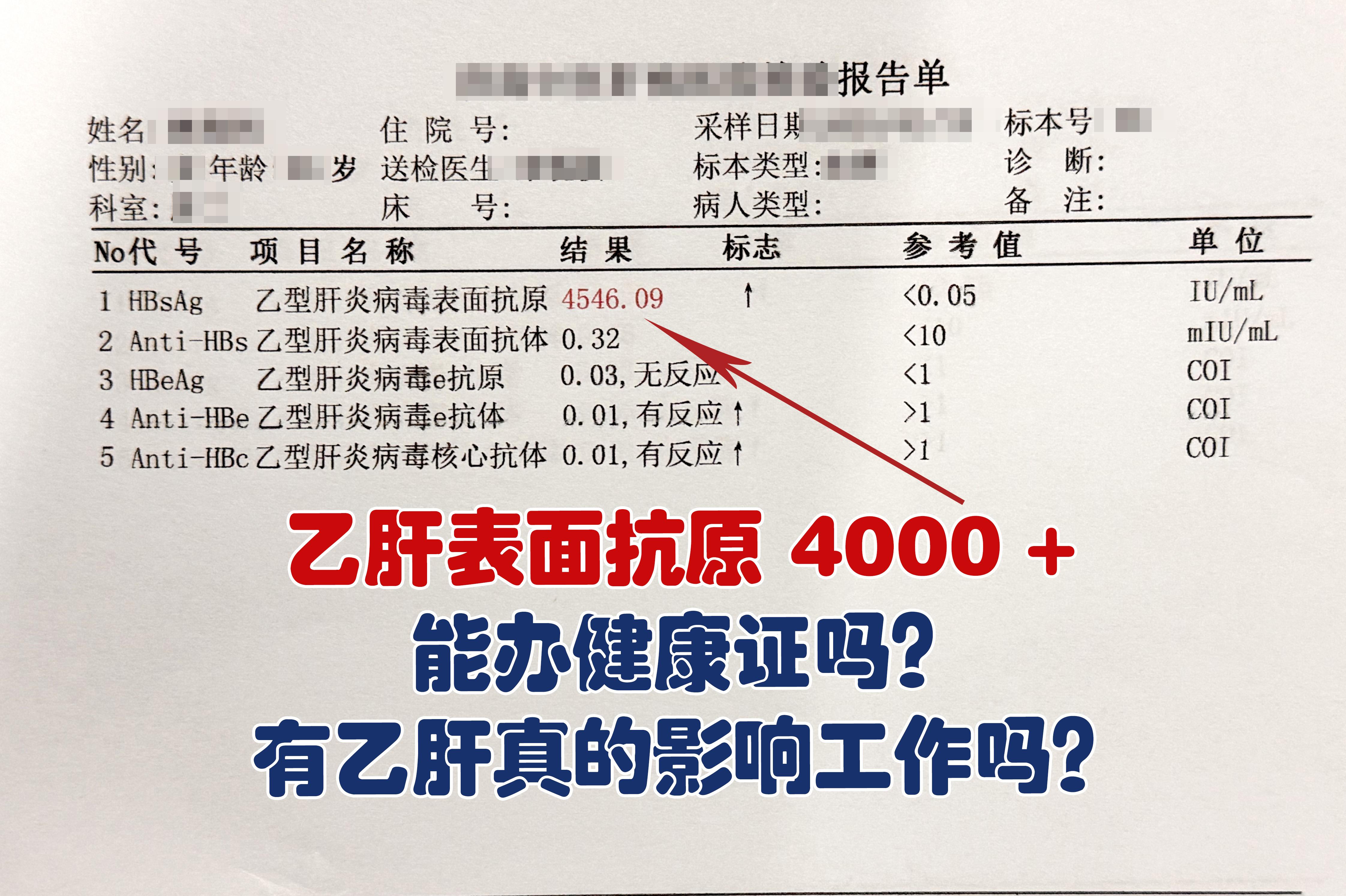 乙肝表面抗原4000+ 能办健康证吗？有乙肝真的影响工作吗？ 4000...