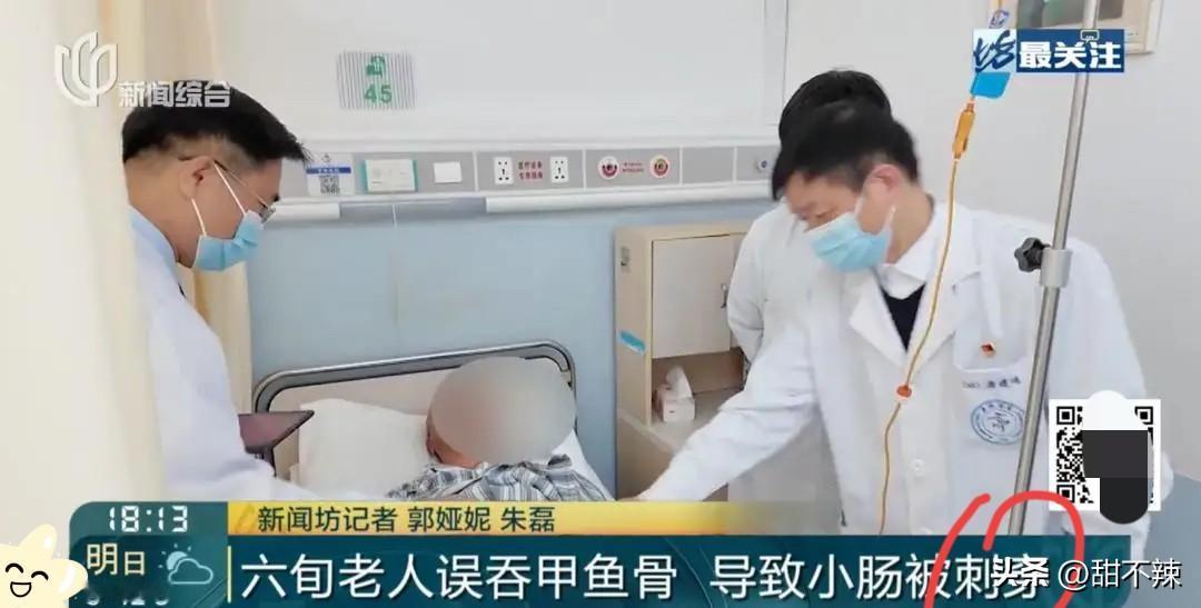 近日，上海，一大爷吃甲鱼进补时，不小心吞下了甲鱼骨头，吃完后没多久，肚子就出现剧