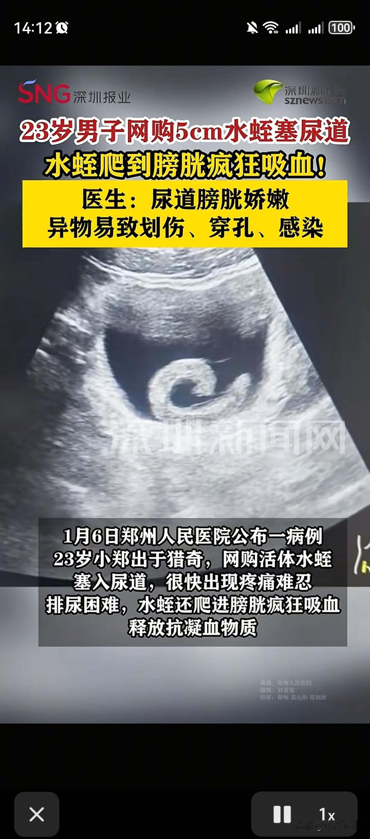 “再也不敢了”近日，河南郑州一名23岁的男子闲着太无聊了，在网上认识了一些网友