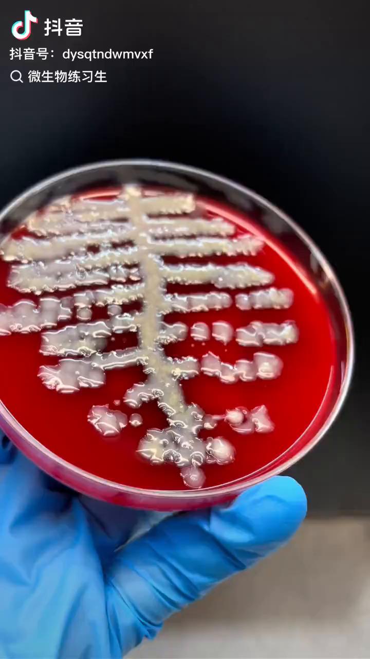 微生物练习生：肺炎克雷伯菌拉丝实验。大家都在肺炎克雷伯图片显微镜下。