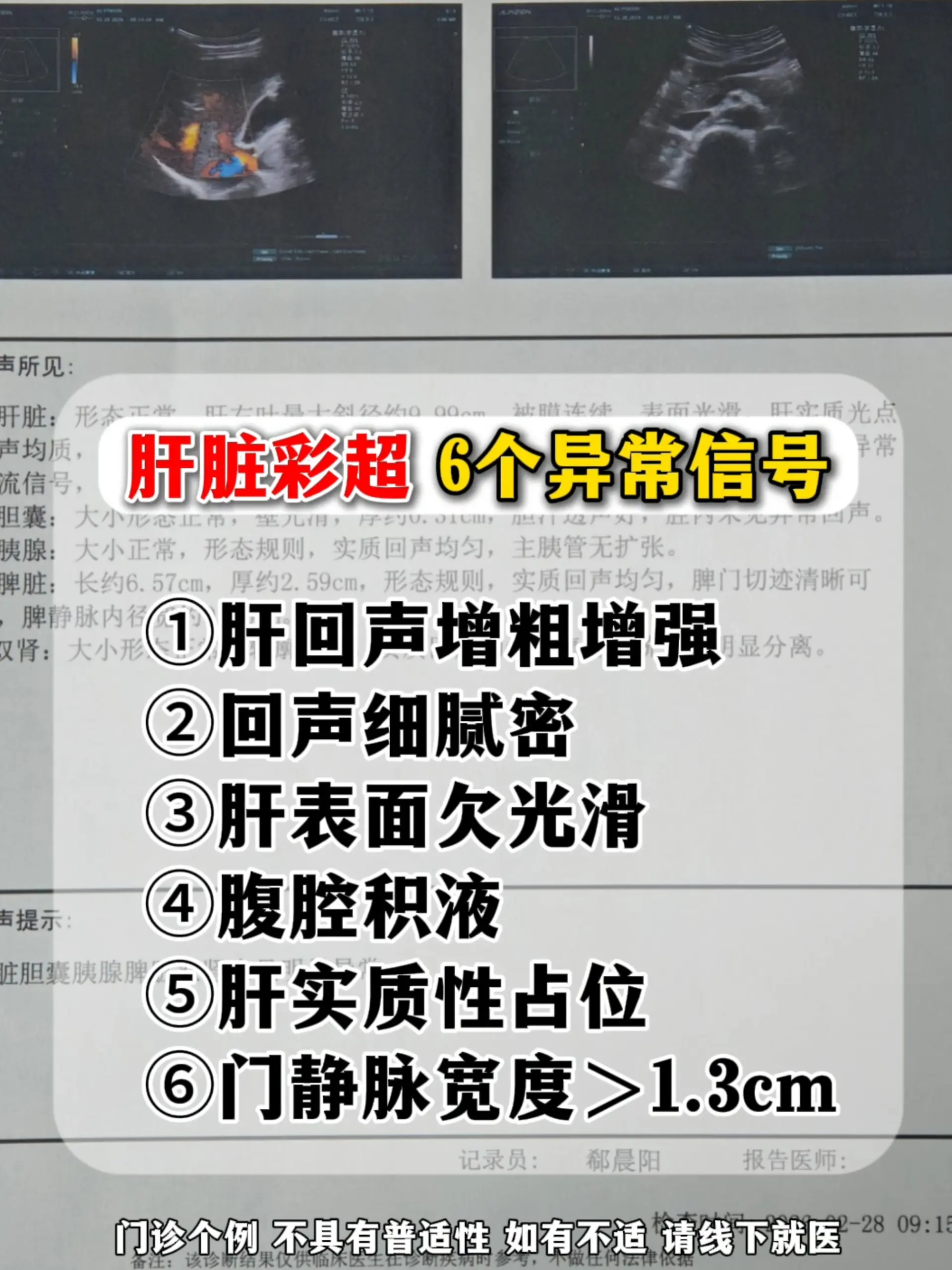 对肝病患者来说，肝脏彩超是性价比超高的影像学检查：价格亲民、无创便捷...
