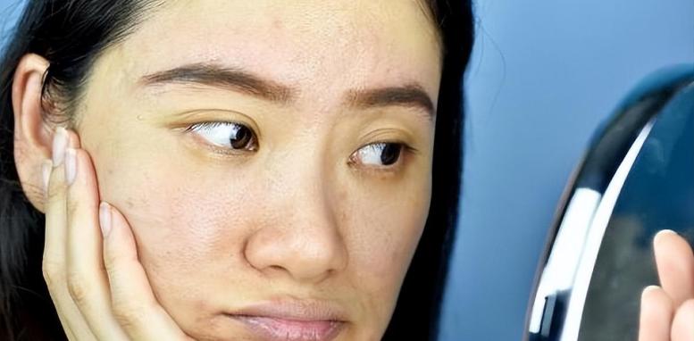 身患糖尿病看脸就可以知道？医生：患上糖尿病的人，脸上或有7表现——别等并发症才后