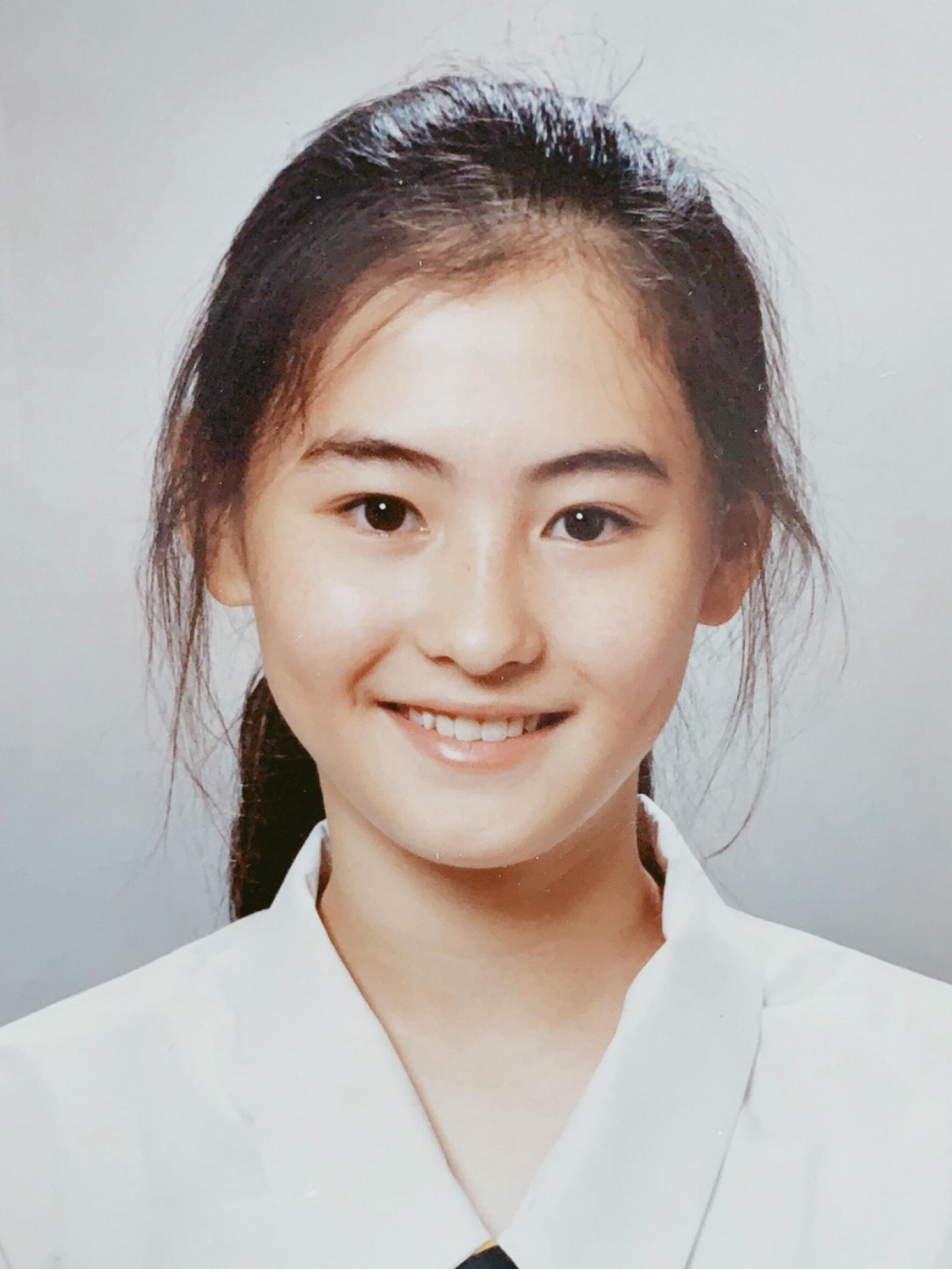 张柏芝牙齿变化少女时期短小、稍显内扣的牙齿其实非常适配她的颌面和嘴形，娇俏灵动