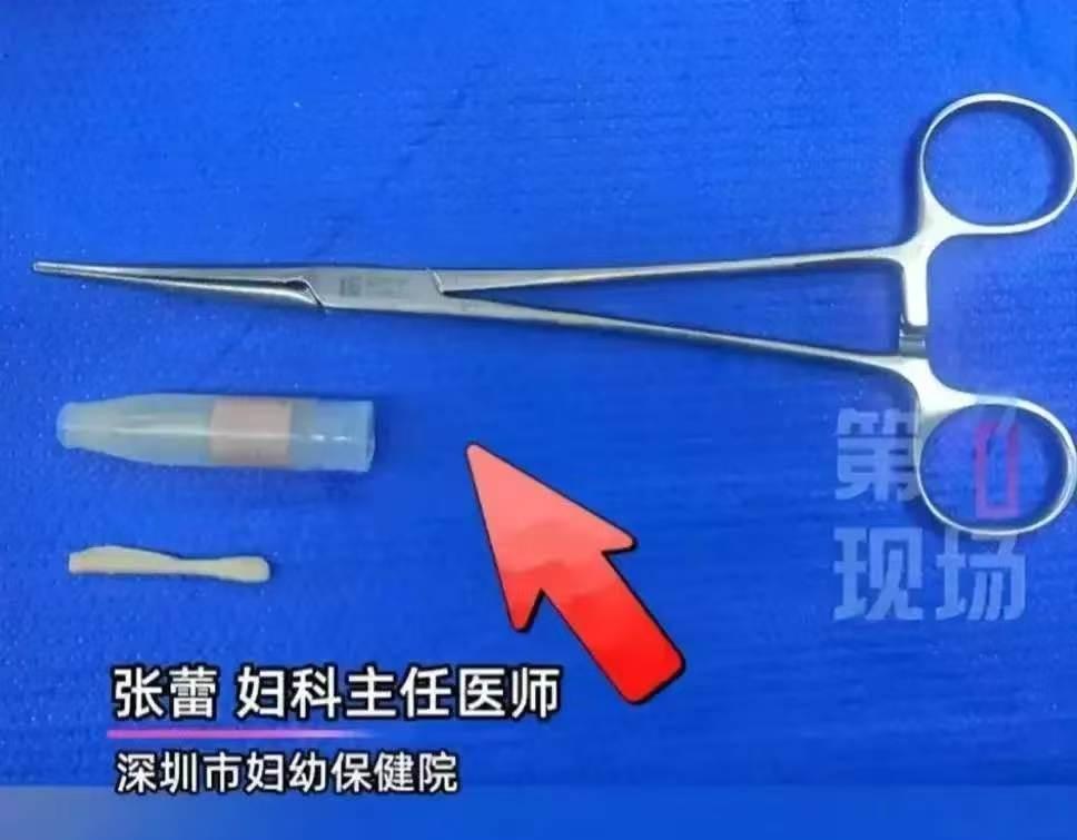 广东一名7岁女孩反复阴道炎，家长折腾许久不见好转。直到医生用内镜探查，才发现阴道