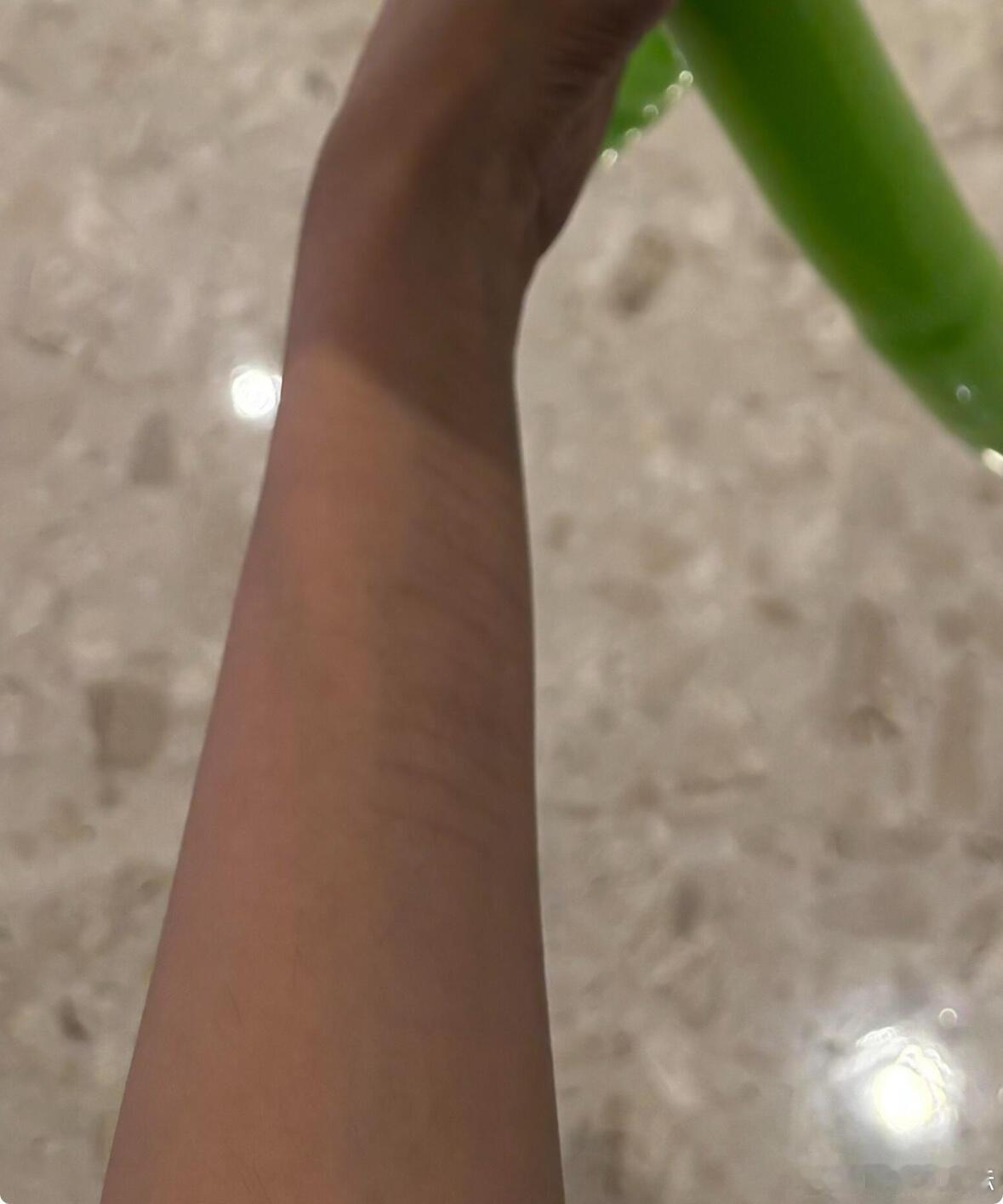 金子涵手臂上疑似有自伤的痕迹​​​