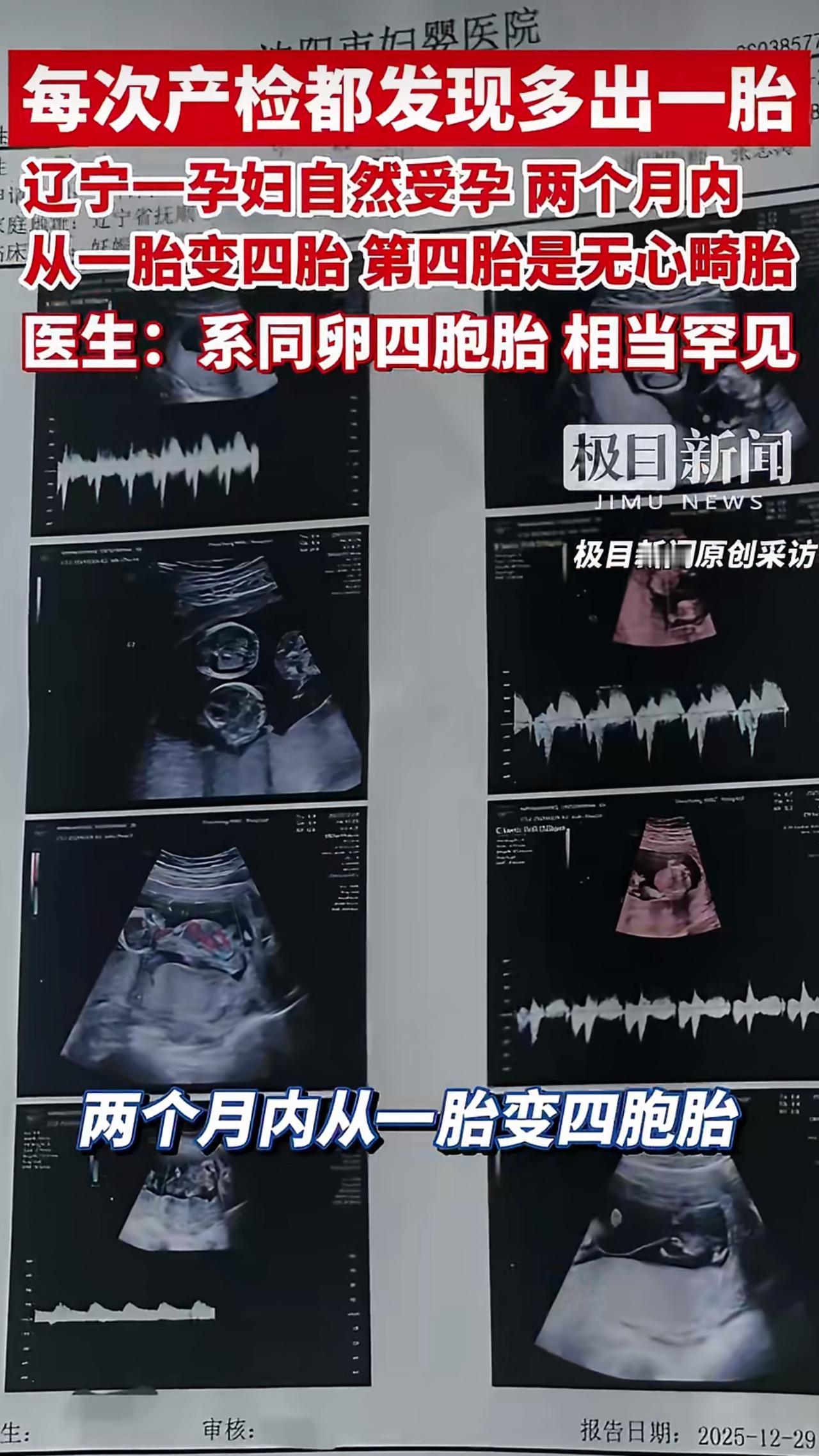 最近有个特别让人惊讶的孕事在辽宁抚顺传开了，一位30岁的王女士在怀孕产检时，每次