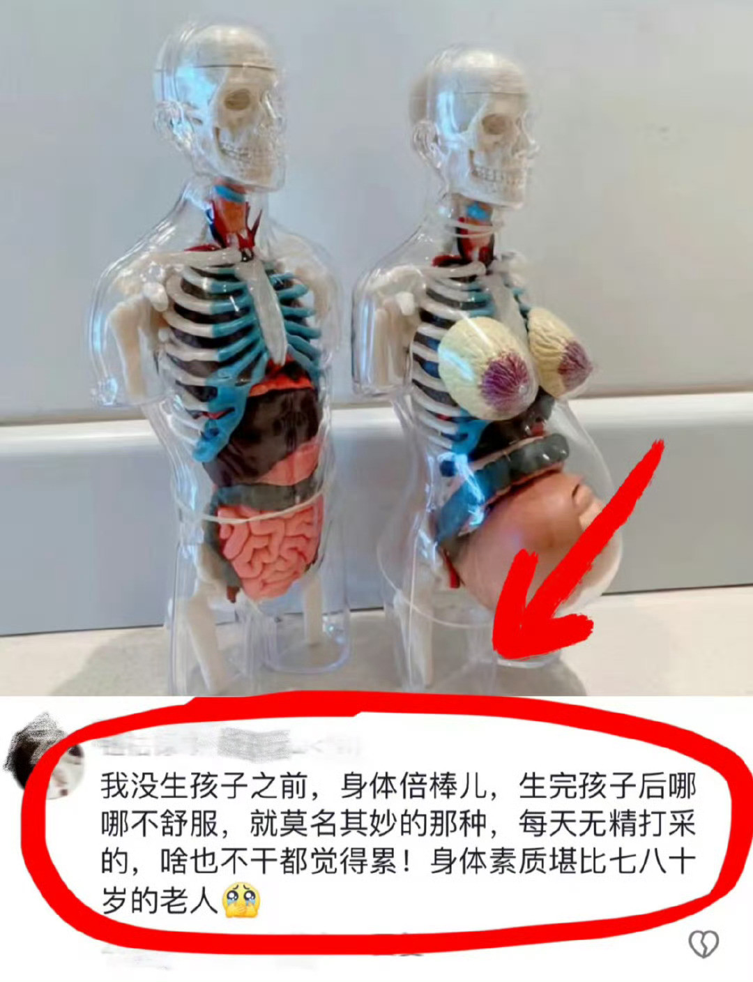 感觉普通人结婚后很难真的不生孩子...