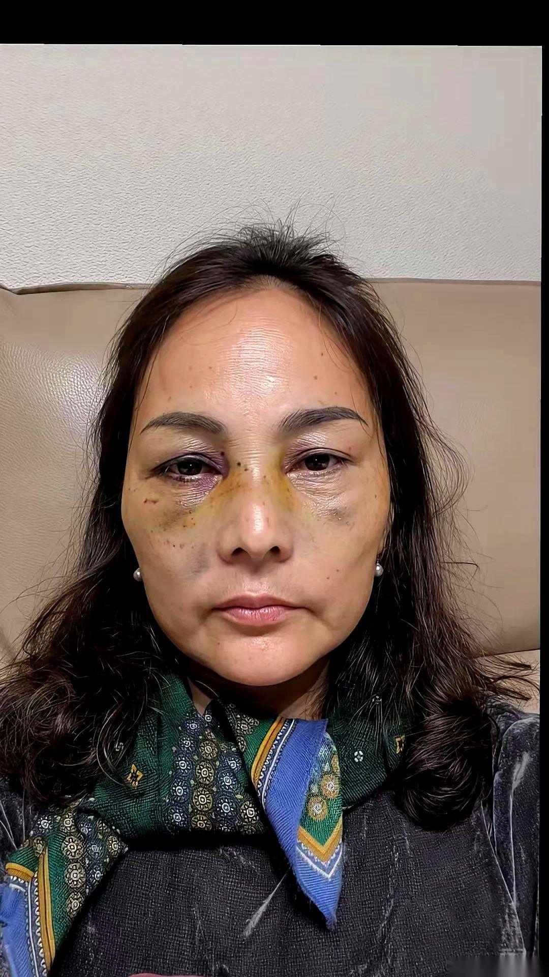 200万。就为了这200万拆迁款，我正眼睁睁看着自己被那个睡了三十年的男人，一