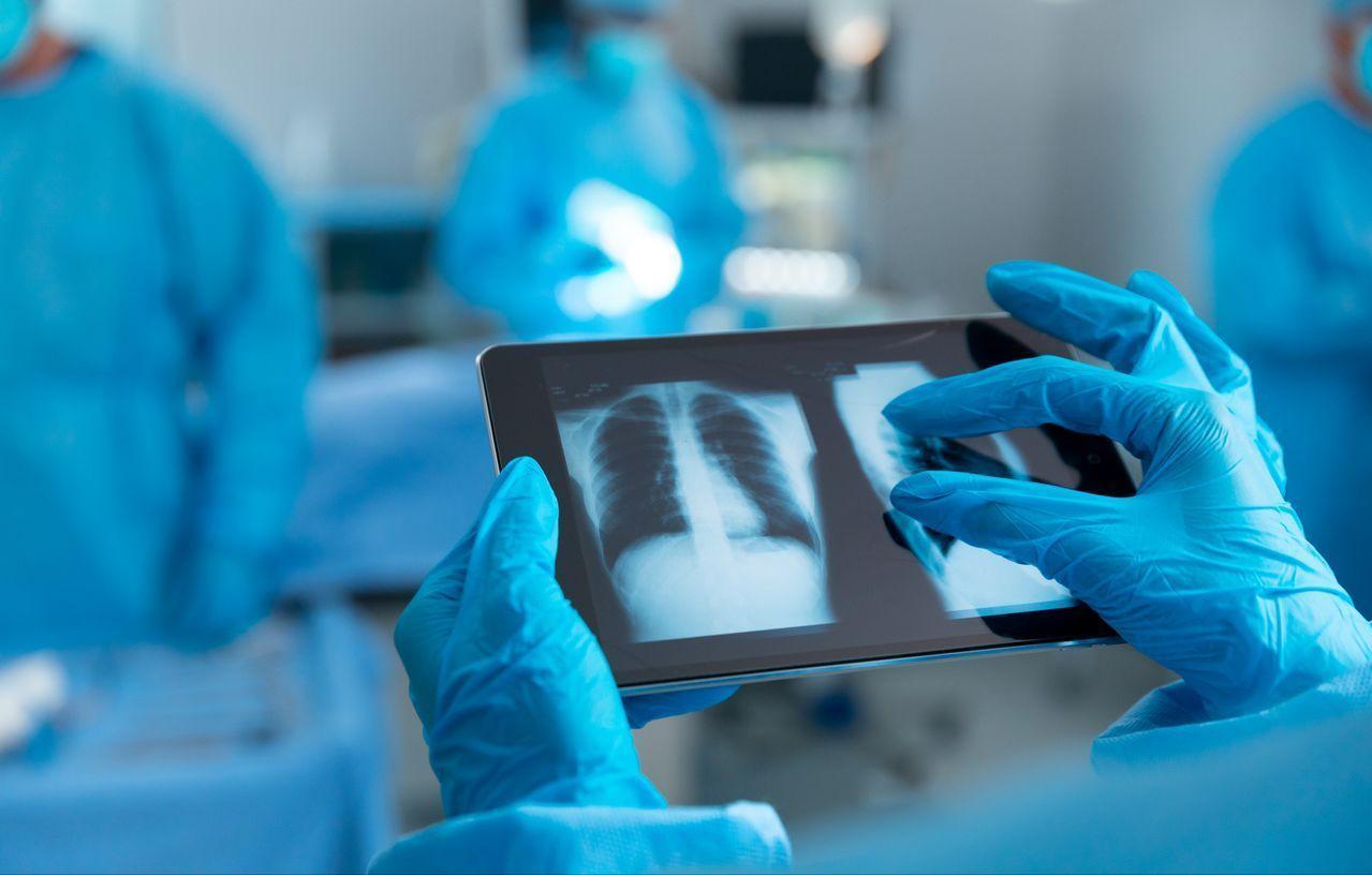 肺部恶性结节手术，为啥要清扫淋巴结？很多肺部恶性结节患者会疑惑：切了结节就行，