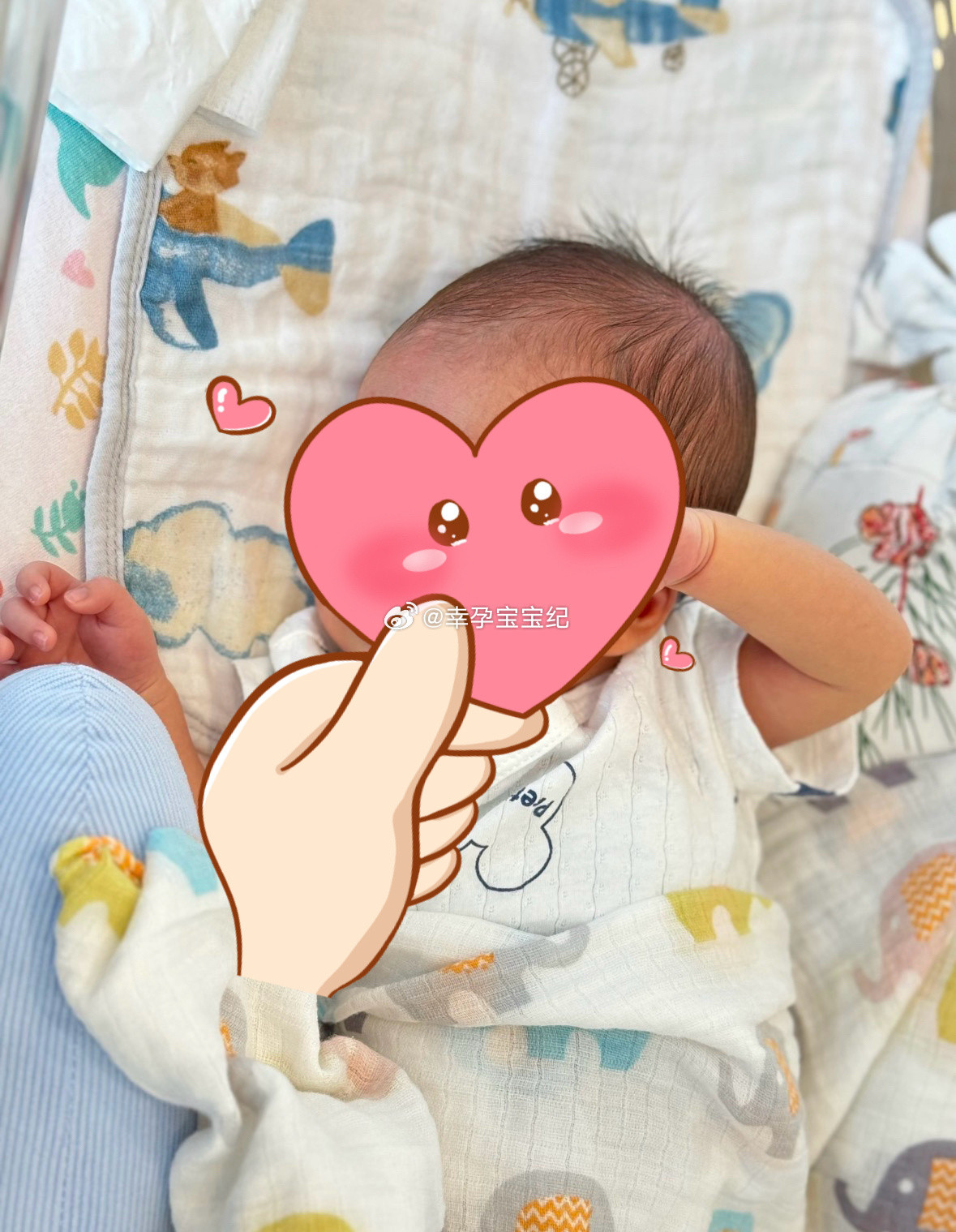 洪女士，幼稚子宫，三径不到60mm，从没来过月经。但想有个孩子当妈妈这个想法从没放弃！好在她的卵巢是