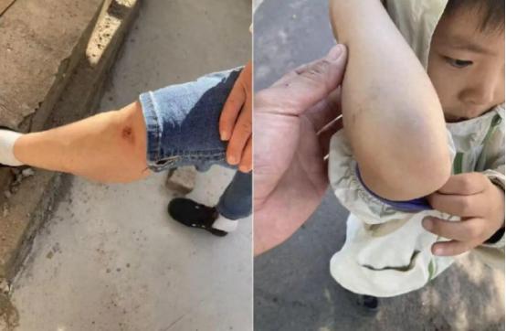 5月12日，河南58岁奶奶骑电动车接6岁孙子，刚开几米车把突然锁死，祖孙俩狠摔在