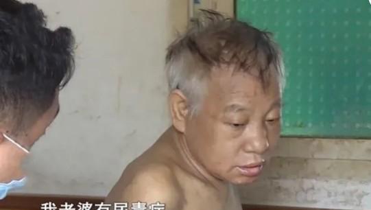 2009年，捐肾救妻的模范丈夫，12年后住院发现双肾都在，子女无法接受，怒问其父