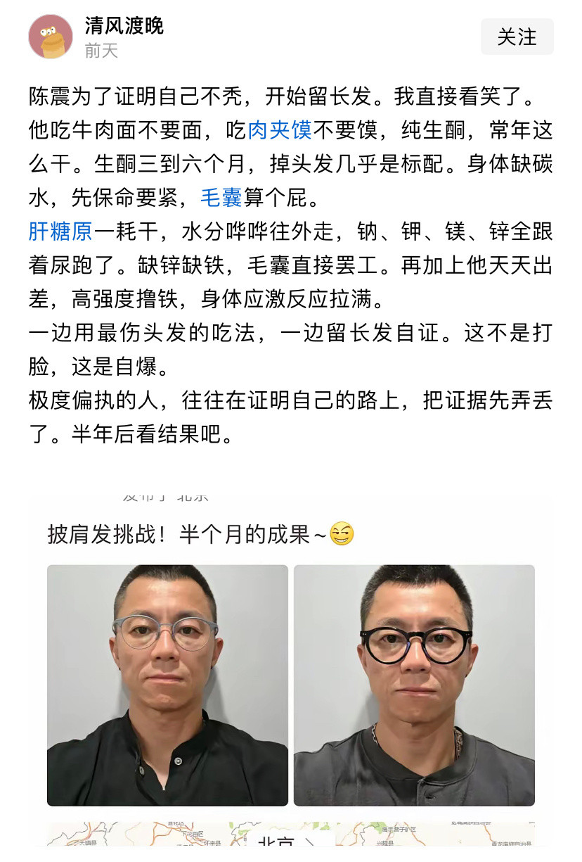 网友也是闲的慌，开始关注陈震掉不掉头发😆​​​