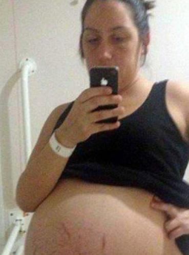 孕妇产下男孩后感觉有异样, 检查结果让全家喜出望外!