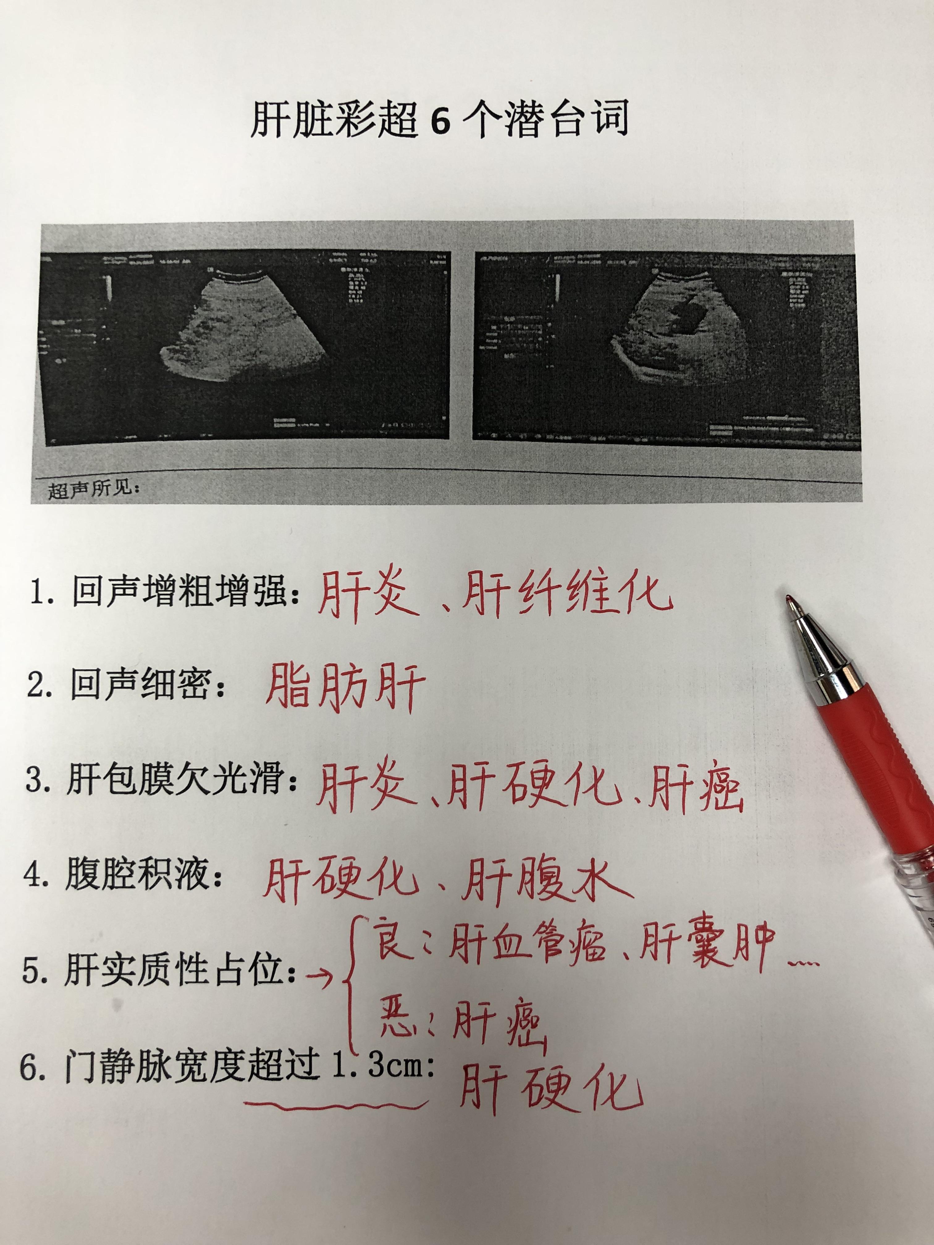 肝硬化 乙肝 肝炎 健康科普