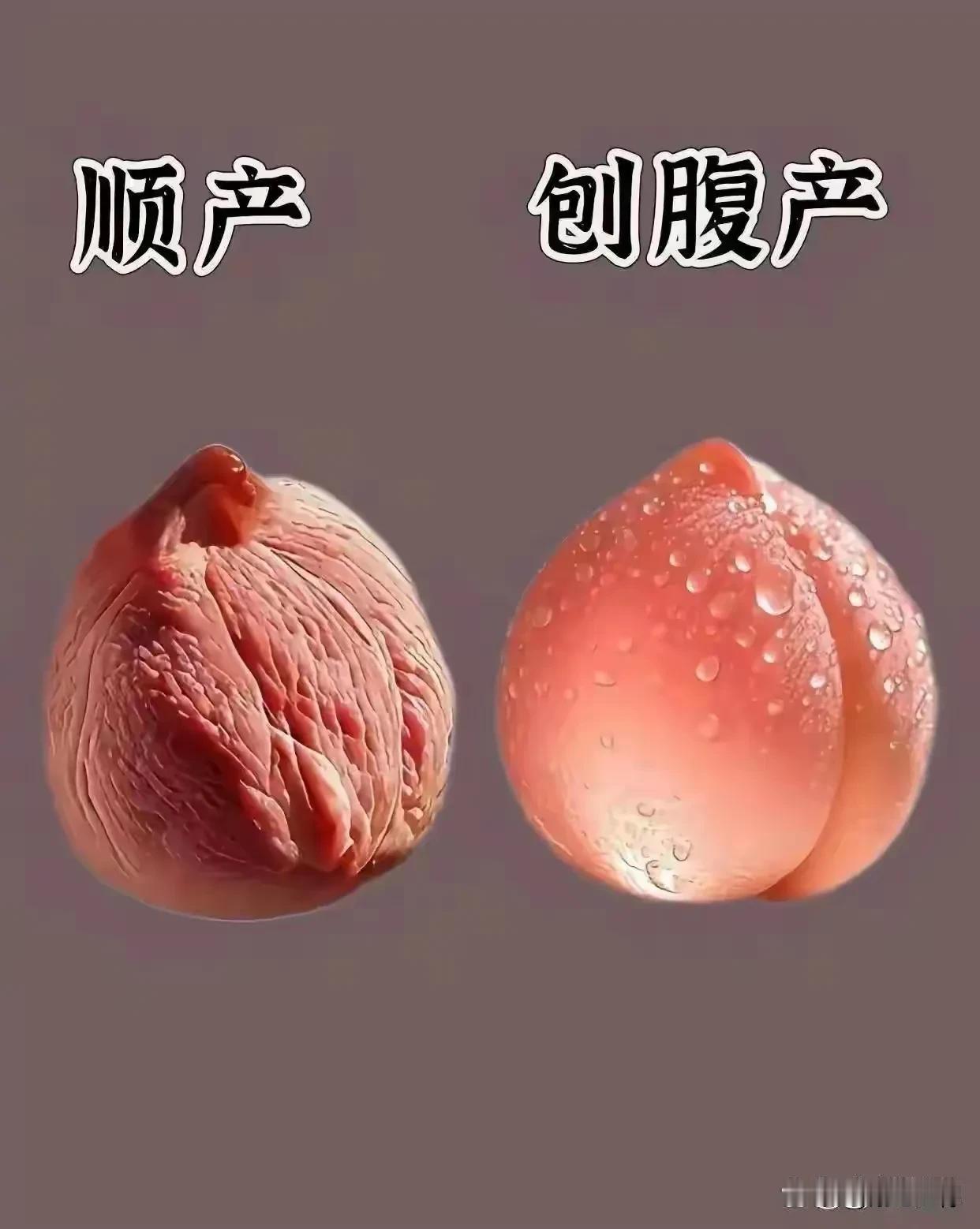 顺产和剖腹产，哪个更好？我不敢乱评，只说我小时侯经历过的事说一说:那一天，我家母