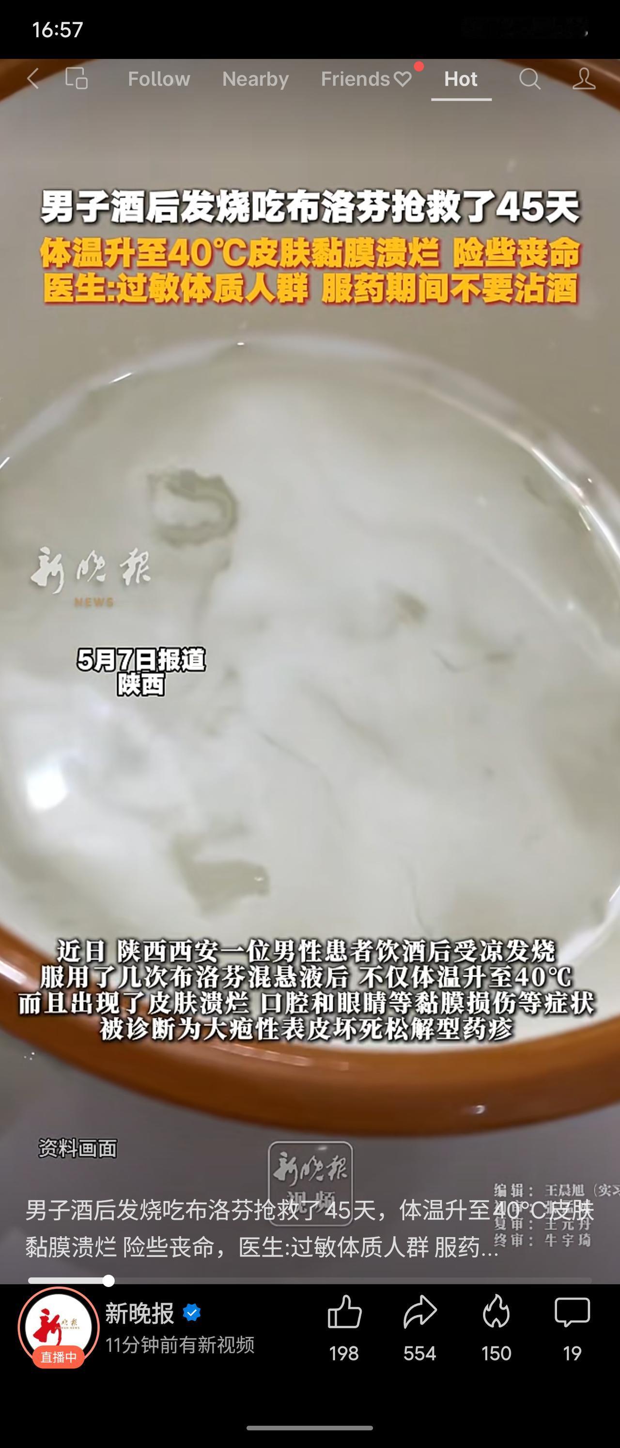 陕西一男子酒后发烧，自行服用布洛芬，导致大疱性表皮坏死松解型药疹，体温升至40℃