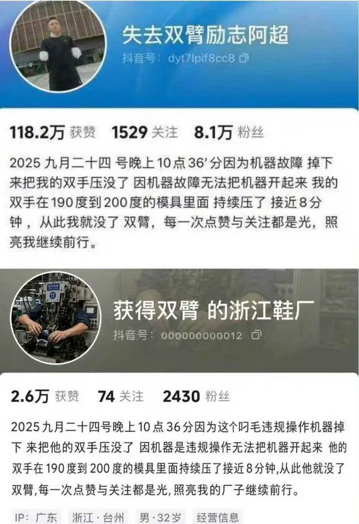 看了“浙江鞋厂阿超断臂”事件经过，从网传版本来看，浙江台州鞋厂事故，工人阿超在夜