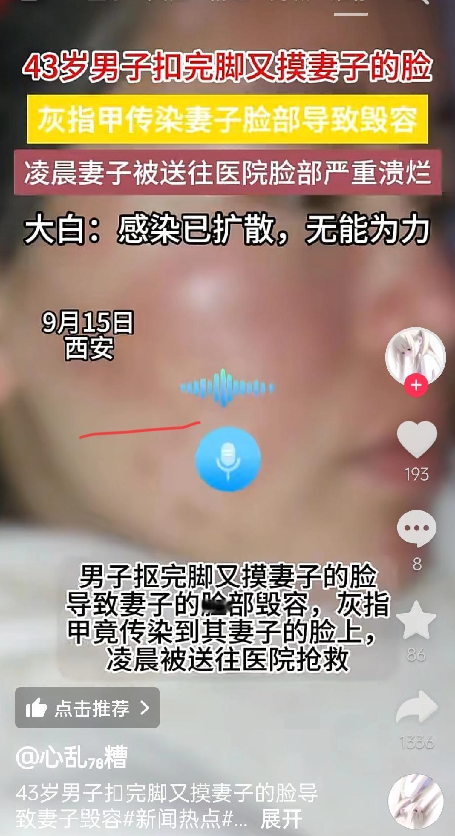这可不是危言耸听！40岁男子抠完脚又摸妻子的脸，结果竟让妻子毁容！现实中真