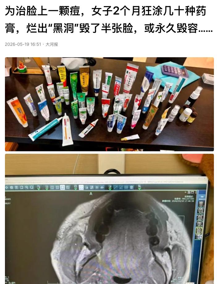 “别拿健康开玩笑！”浙江杭州的吴女士，将面部异常肿块错认成痘痘，一味靠各类药膏自
