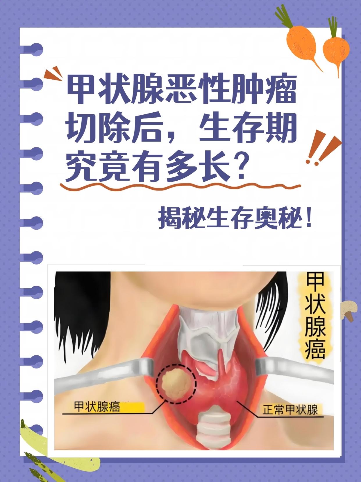甲状腺癌为什么越来越常见？真相扎心了，90%的人都被吓错了！打开体检报告，“