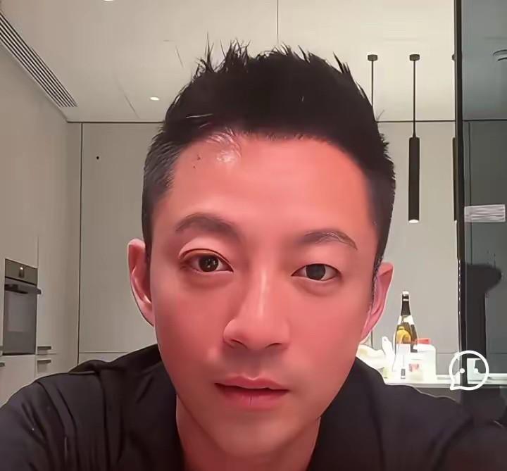 汪小菲眼睛怎么了？众所周知，汪小菲是小眼睛单眼皮，这几天不知道怎么了，直播间突