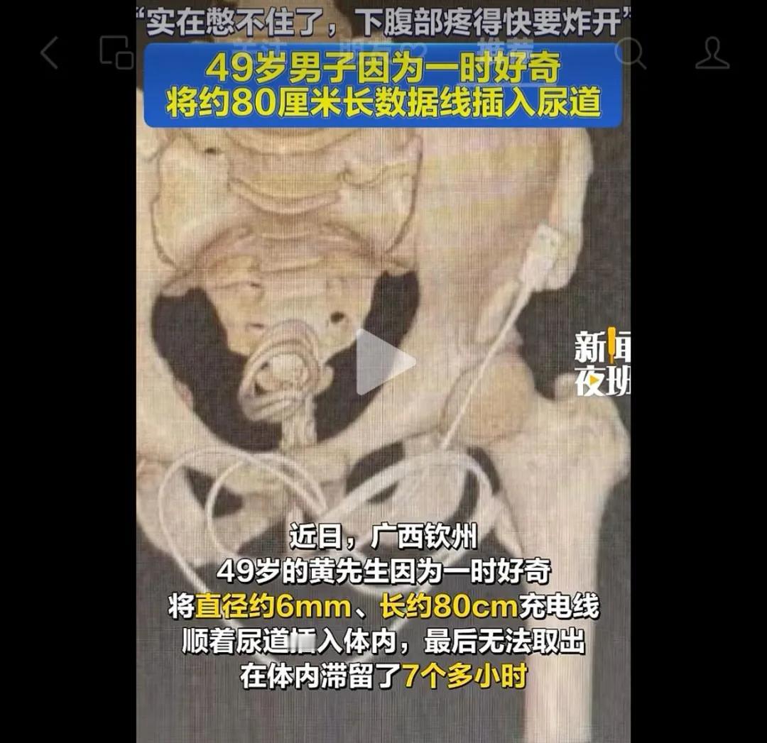 我感觉我的世界观被重塑了