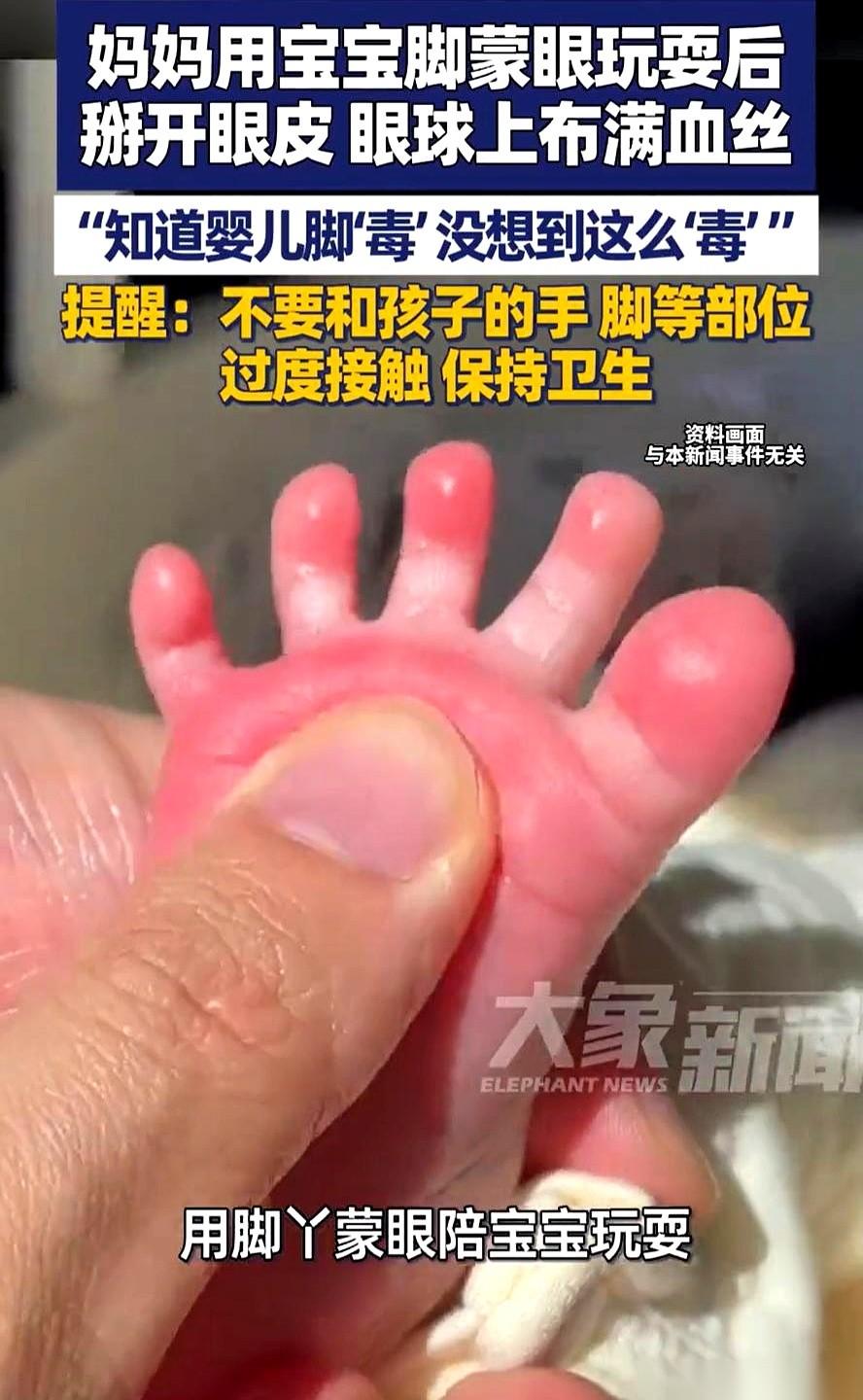 江苏一位宝妈，就干了一件事，一只眼睛差点“废了”。她在家带娃，看着床上蹬着腿的