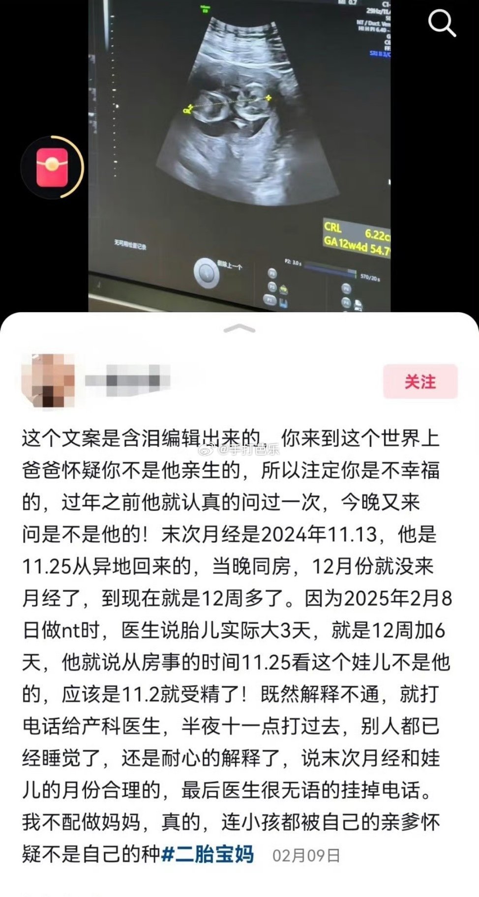 孕妇和家属低学历也算高危产妇是有道理的​​​