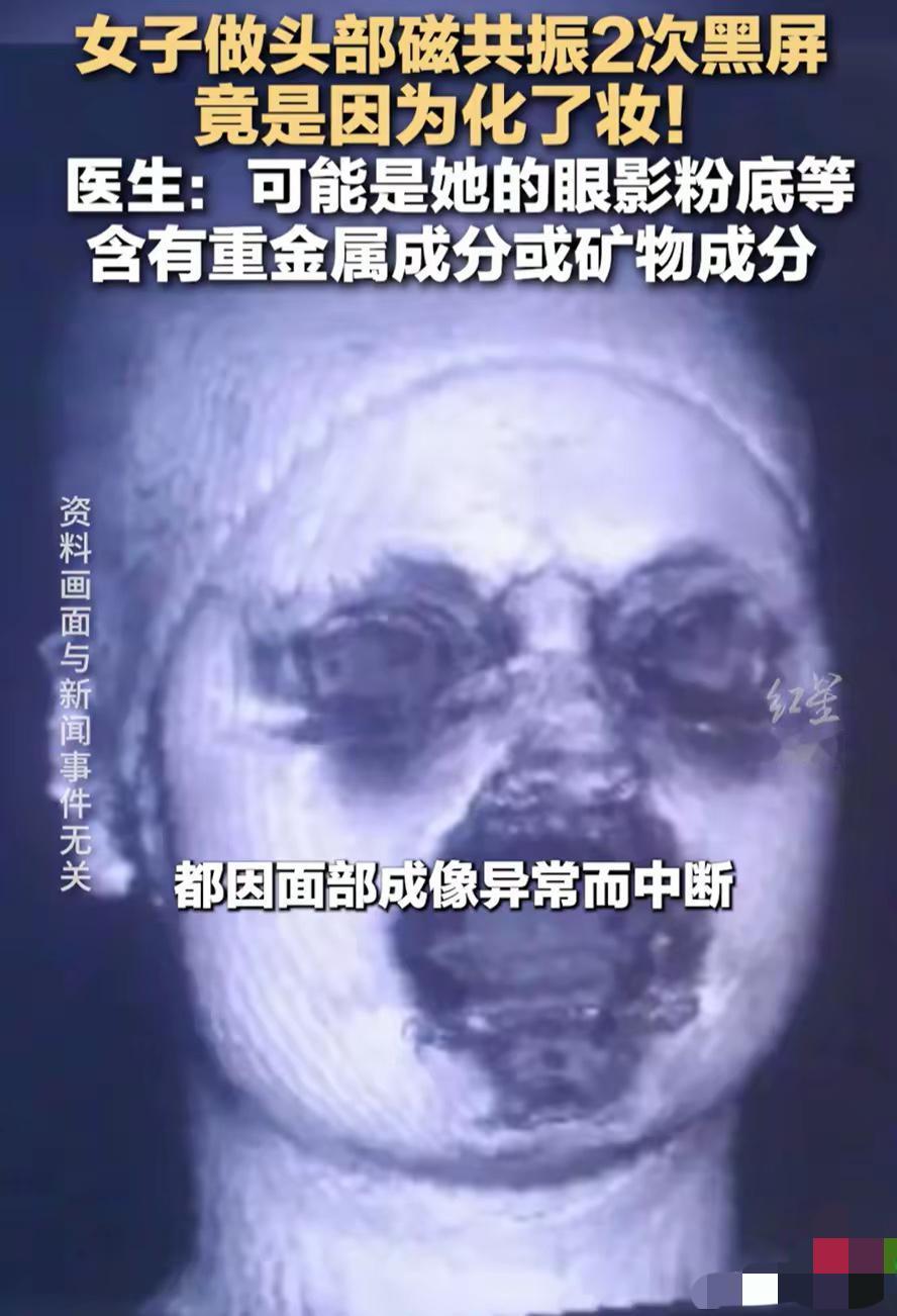 谁能想到，每天涂的淡妆居然能让医院的磁共振直接“罢工”？福建29岁姑娘头晕做