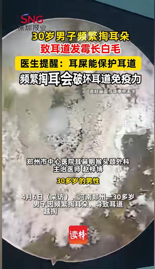 “悲剧还是发生了！”近日，河南郑州，一位30岁男子，平时就喜欢掏耳朵，一闲下来
