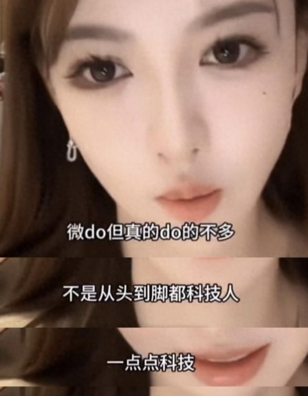 叶珂产后塑形：Onda微波溶脂成“救星”33岁的叶珂在直播里没藏着掖着，坦言产