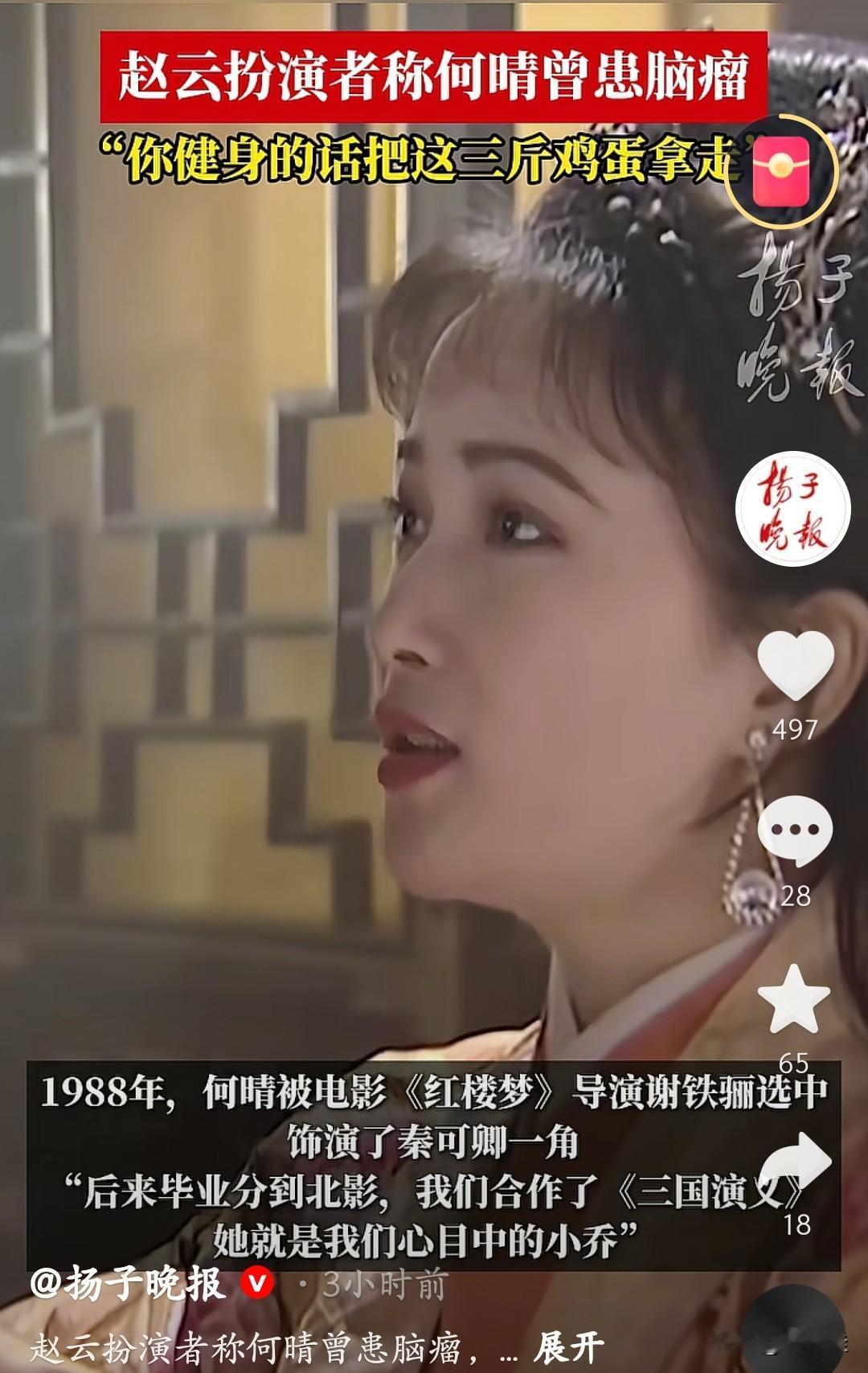 何晴去世的原因找到了！这位演遍四大名著的“古典第一美人”，其实已经和脑瘤悄悄抗争