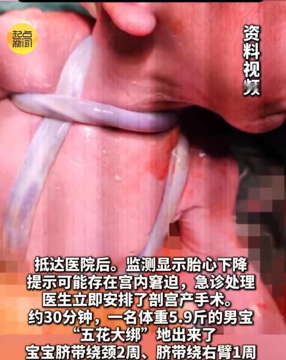 陕西，一怀孕的38周孕妇感觉到自己肚里的胎儿4个小时内只动了一次，她怀疑孩子可能