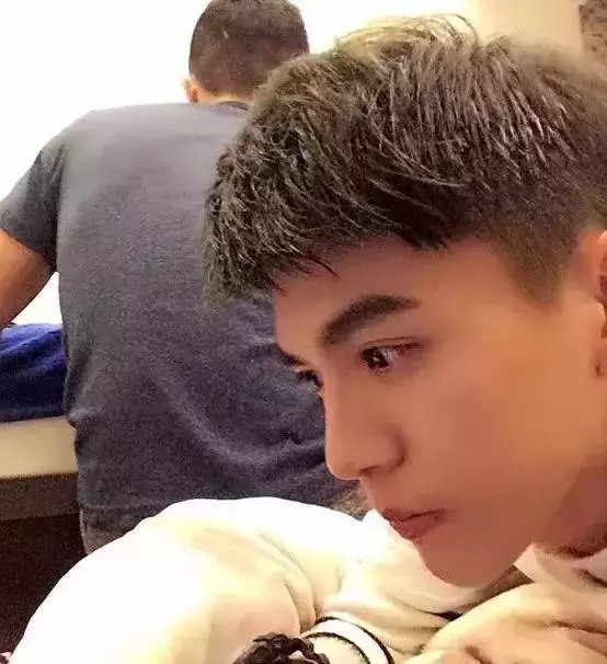 【案例】男生割了双眼皮之后, 好帅好帅好帅! ! !