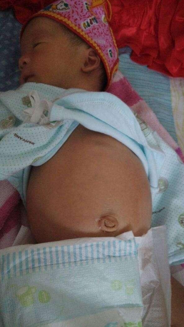 新生宝宝会肚子大, 了解后救了宝宝一命!