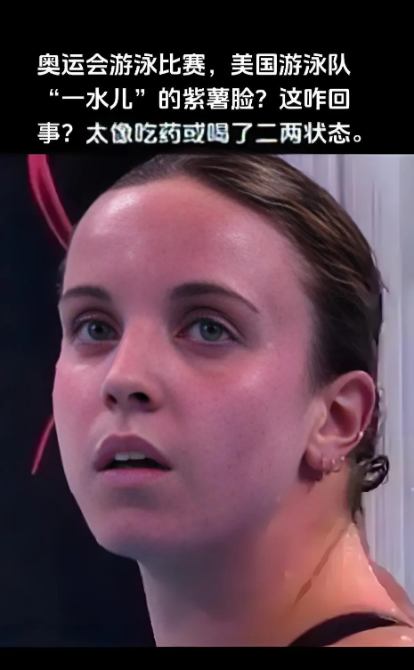 美国游泳队宣称集体食物中毒，然后申请新加坡游泳世锦赛集体医疗豁免。看样子是磕