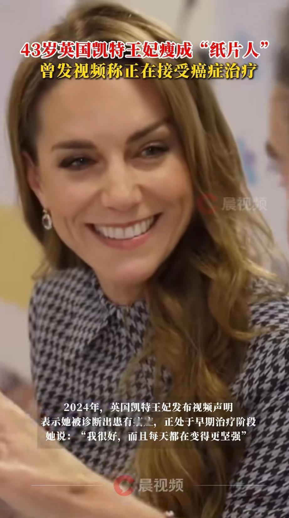 43岁的英国凯特王妃瘦成“纸片人”曾发视频称正在接收癌症治疗。近日她穿千鸟格连