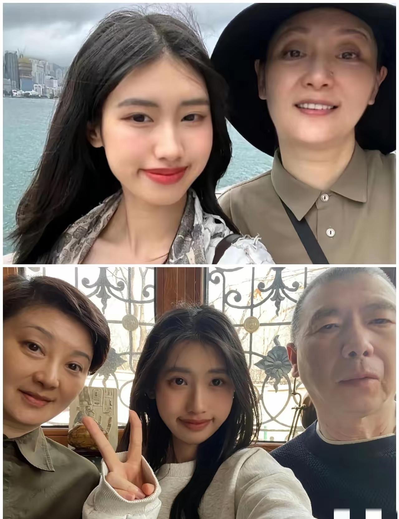 冯小刚女儿越长越像他，连凸嘴都一模一样。白癜风会遗传，但前妻生的女儿很健康。