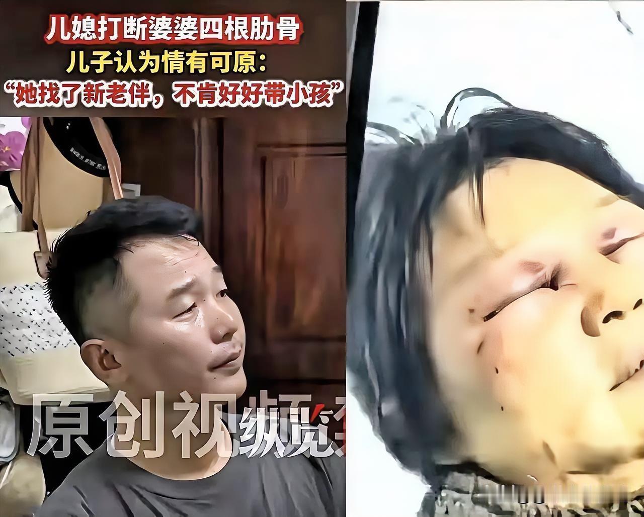 嘉兴儿媳暴打婆婆，打断三根肋骨！最寒心的是儿子的态度刷到浙江嘉兴这件事，真