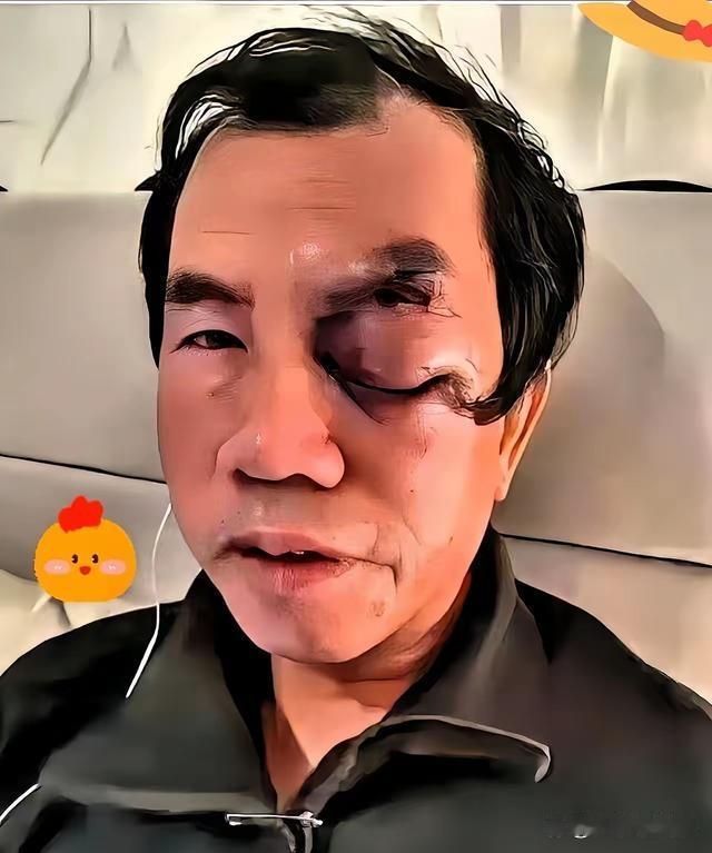 他带着大笔财富移民美国，在那里，每天钓鱼、游泳，生活惬意悠闲，他甚至一度认为美国