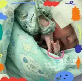 海宁一位妈妈生下“天选女宝”！医生：太罕见了！谁能想到，连节育环都拦不住的
