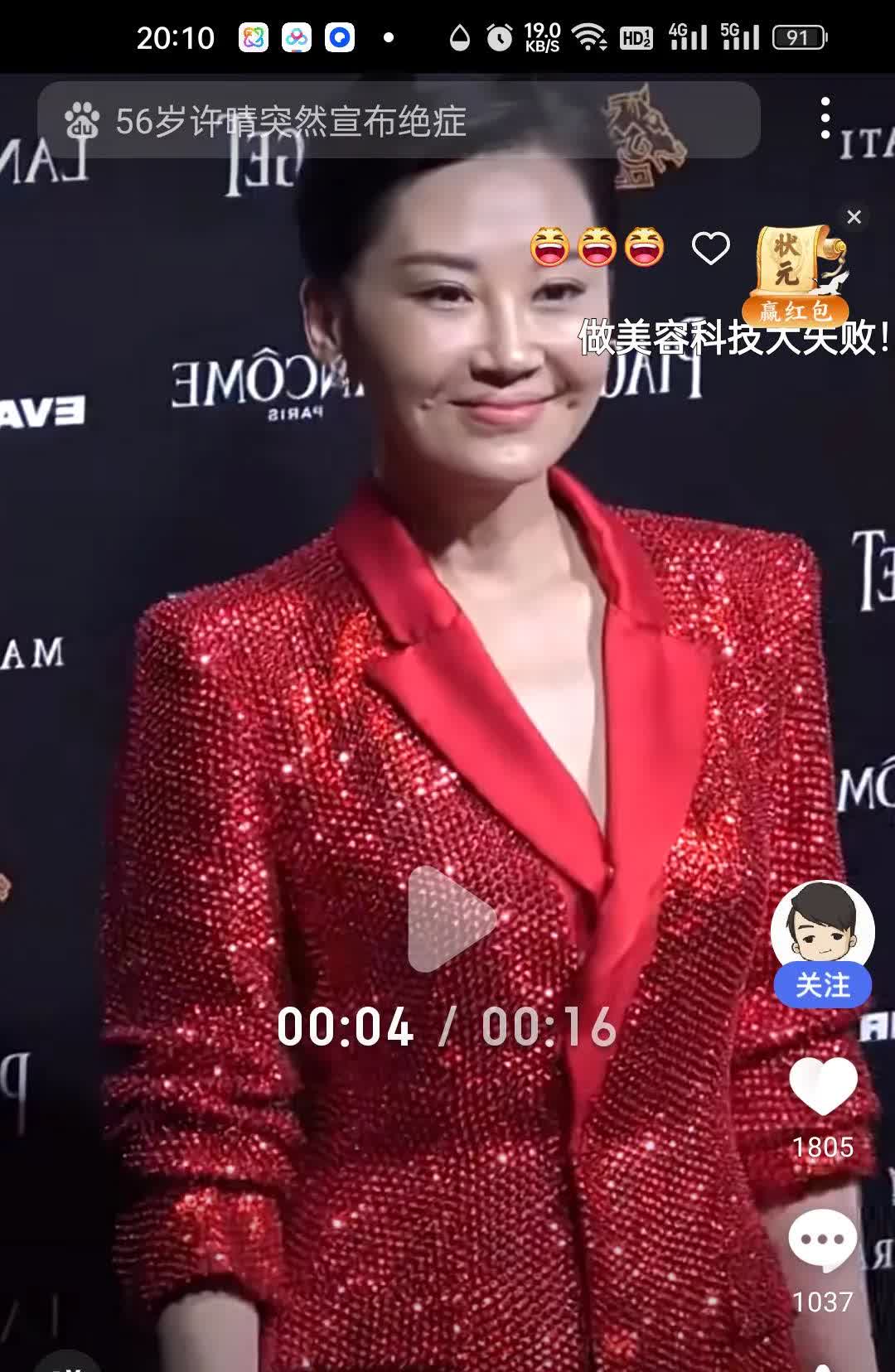许晴变样了，和以前判若两人！仔细看，这4处微调太明显。1.眼睛紧致
