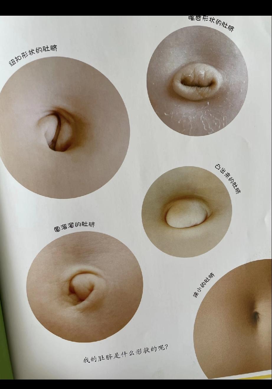 我的天😱这也太涨知识了！！！活了几十年才知道肚脐还有特斯拉形状、奔驰形状的，