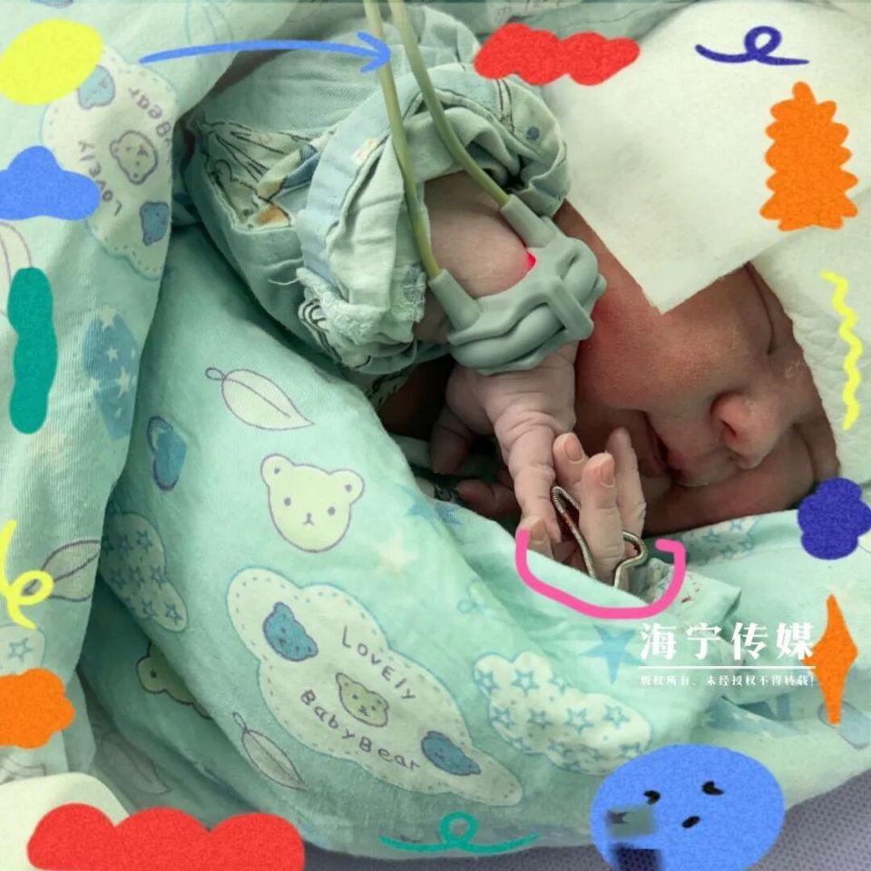 《海宁“天选女宝”降生！医生直呼罕见：这概率比中彩票还低》35岁河南籍妈妈在